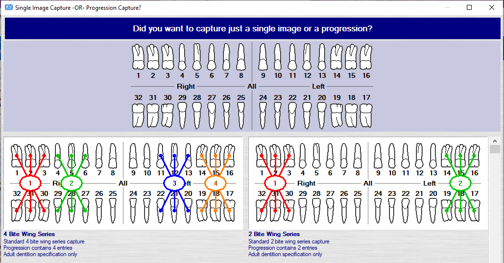 2_single_image_capture_or_progression_capture.png