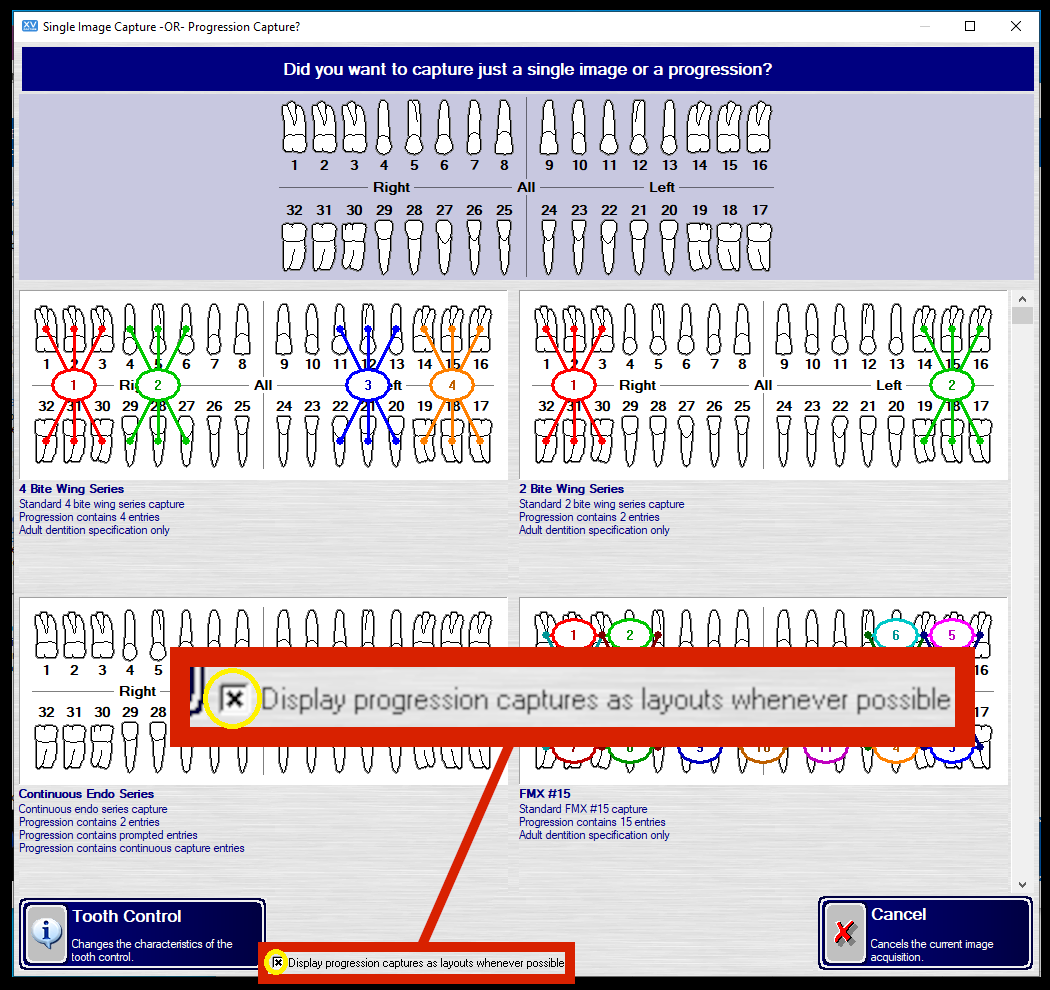 3_display_progression_captures_checkbox.png