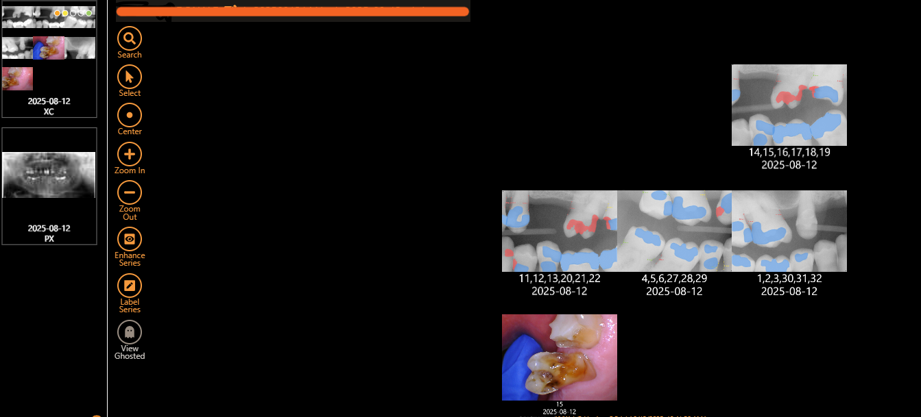 airesultsappearwithoutbuttons.png