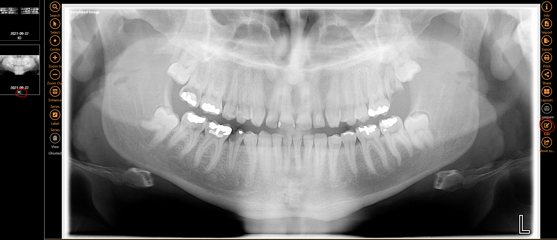 no_x-rays1.PNG