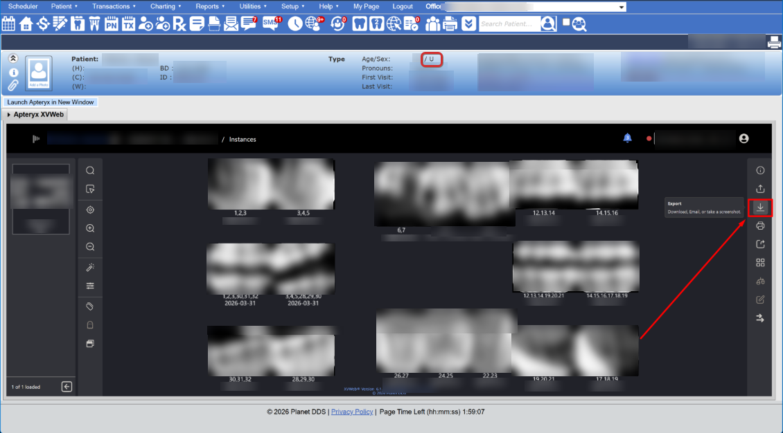 Example of how to export X-ray study for patient with gender marker U