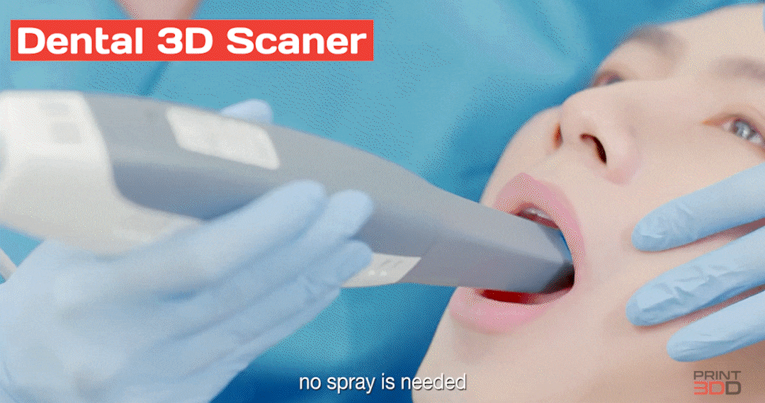 dental-scan.gif
